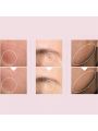 Anua Niacinamide 10% + Txa 4% Dark Spot Correcting Serum - 30ml