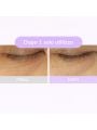 Bioheal BOH Probioderm Collagen Remodelling Eye Patch - 60patches