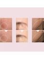 Anua Niacinamide 10% + Txa 4% Dark Spot Correcting Serum - 30ml