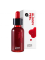 Skin1004 Zombie Beauty Bloody Peel 30ml