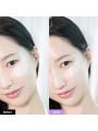 Bioheal BOH Probioderm Collagen Remodelling Eye Patch - 60patches