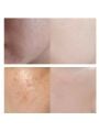 Dr.Melaxin Tx-Cream - 50ml
