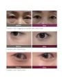 Dr.Melaxin Cemenrete Calcium Dark Spot Eye Cream - 15g