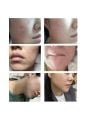 Dr.Melaxin Exosome Repair Ampoule Plus - 40ml