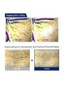 Mediheal PDRN Lifting Pad 100pcs - 170ml