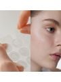 Somebymi 30 Days Miracle Micro Pin Spot Patch - 9pcs
