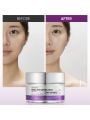 VT Cosmetics Reedle Shot Lifting Cream- 50ml