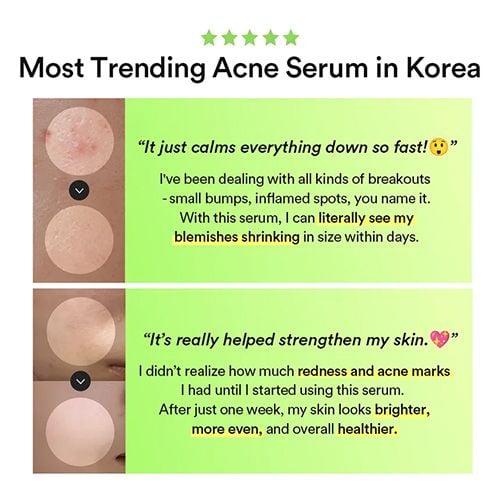 Abib Heartleaf Teca Capsule Serum Calming Drop - 50ml