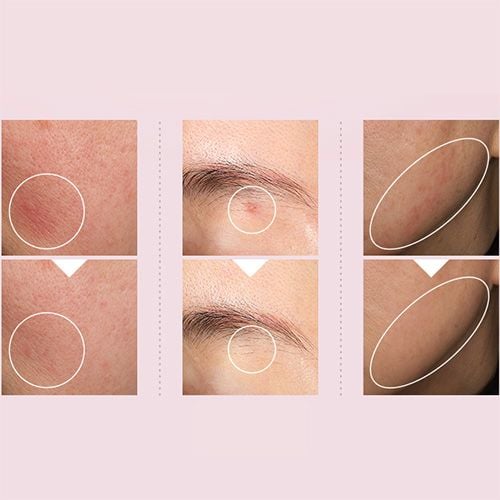 Anua Niacinamide 10% + Txa 4% Dark Spot Correcting Serum - 30ml