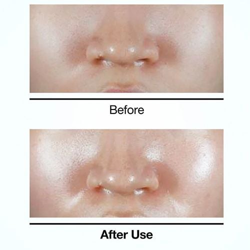 Anua PDRN Hyaluronic Acid Hydrating Capsule Mist - 100ml