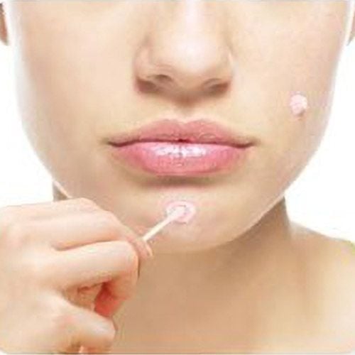 Mizon Good Bye Blemish Pink Spot - 20ml
