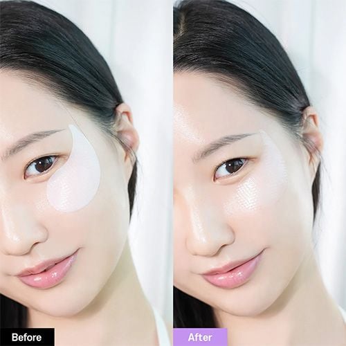 Bioheal BOH Probioderm Collagen Remodelling Eye Patch - 60patches