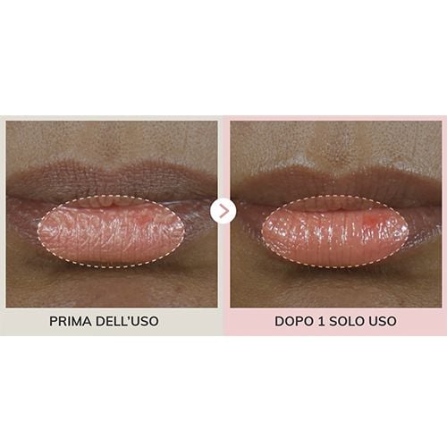 Dr.Reju-All Advanced Pdrn Rejuvenanting Lip Serum - 10ml