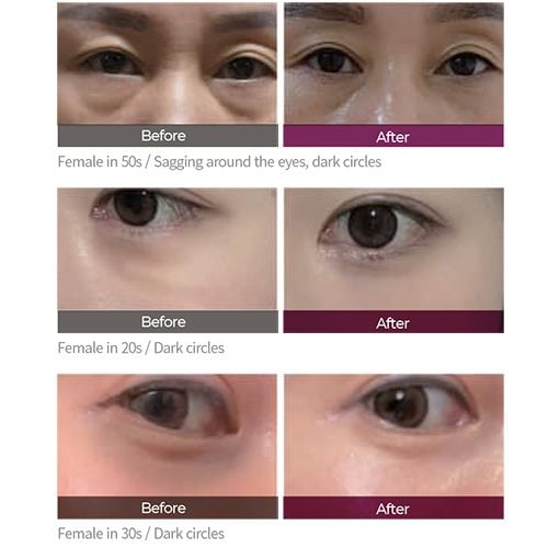 Dr.Melaxin Cemenrete Calcium Dark Spot Eye Cream - 15g