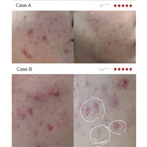 Dr.Melaxin Exosome Repair Toner - 300ml