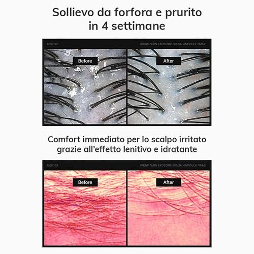 Lilyeve Grow: Turn Exosome Brush Ampoule Black Prime - 100ml