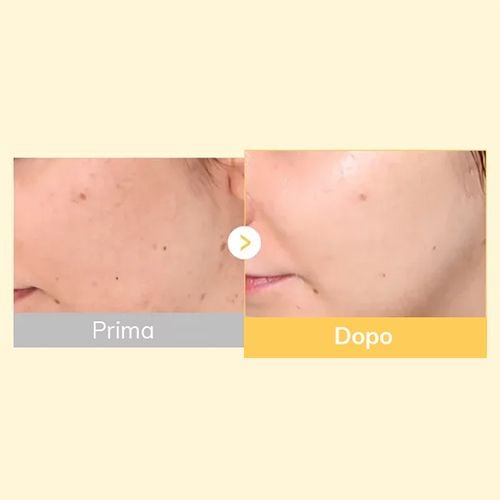 Medicube Kojic Acid Turmeric Brightening Gel Mask - 28g