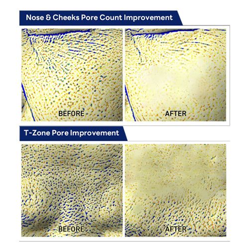 Mediheal PDRN Lifting Pad 100pcs - 170ml
