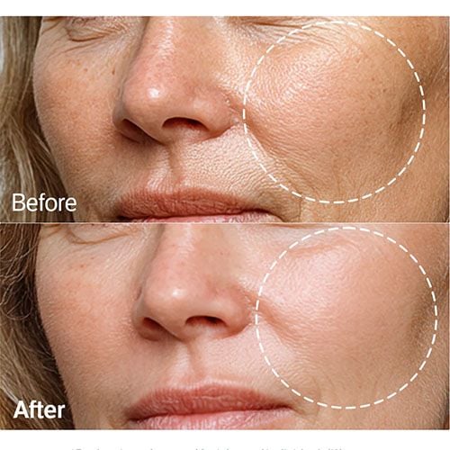 Sungboon Editor Deep Collagen Barrier Serum Mist - 100ml