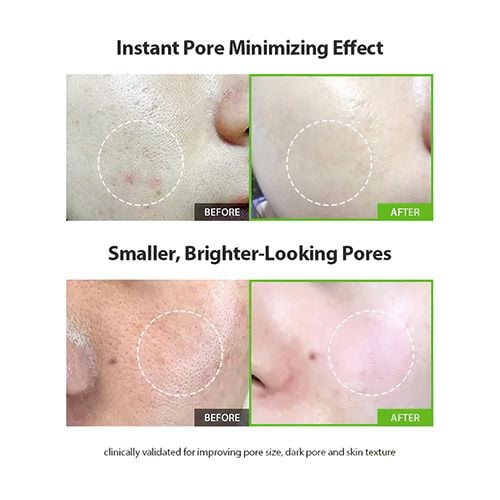 Sungboon Editor Green Tomato Pore Lifting Ampoule + - 30ml