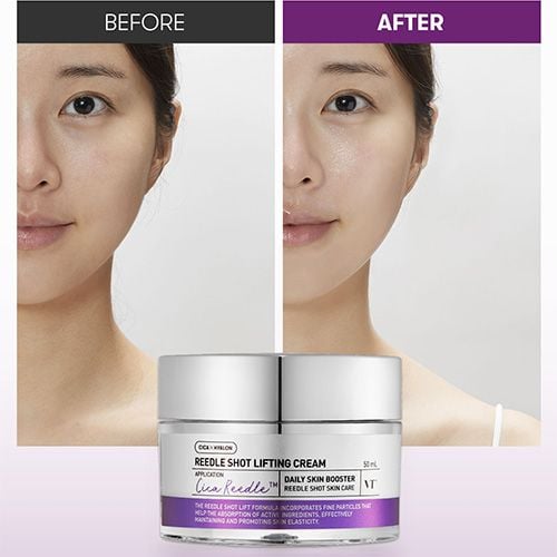 VT Cosmetics Reedle Shot Lifting Cream- 50ml