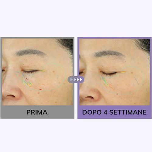 Centellian24 360 Shot Pdrn Active Serum - 50ml