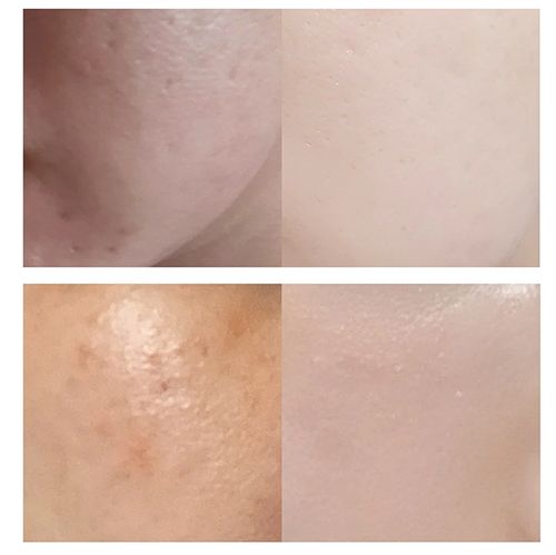 Dr.Melaxin Tx-Cream - 50ml