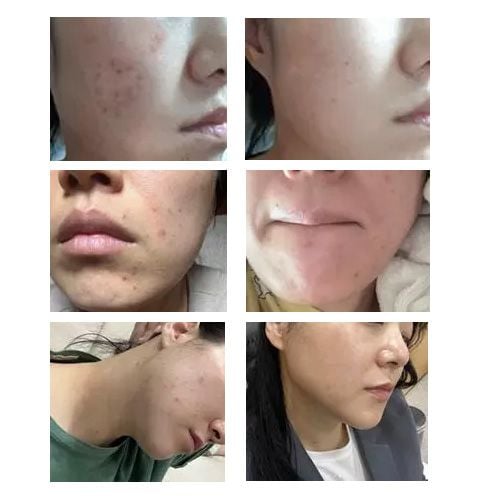Dr.Melaxin Exosome Repair Ampoule Plus - 40ml