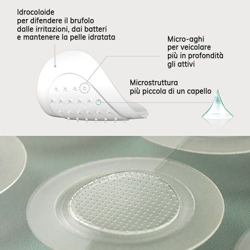 Somebymi 30 Days Miracle Micro Pin Spot Patch - 9pcs