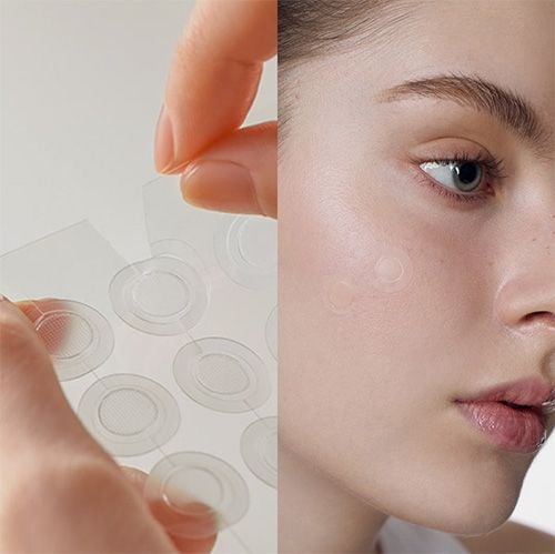 Somebymi 30 Days Miracle Micro Pin Spot Patch - 9pcs
