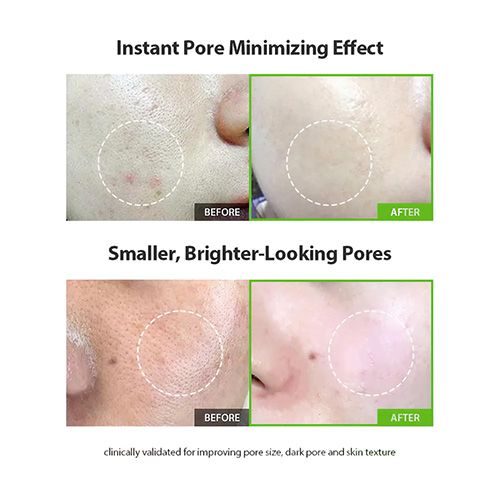 Sungboon Editor Green Tomato Pore Lifting Ampoule + - 30ml