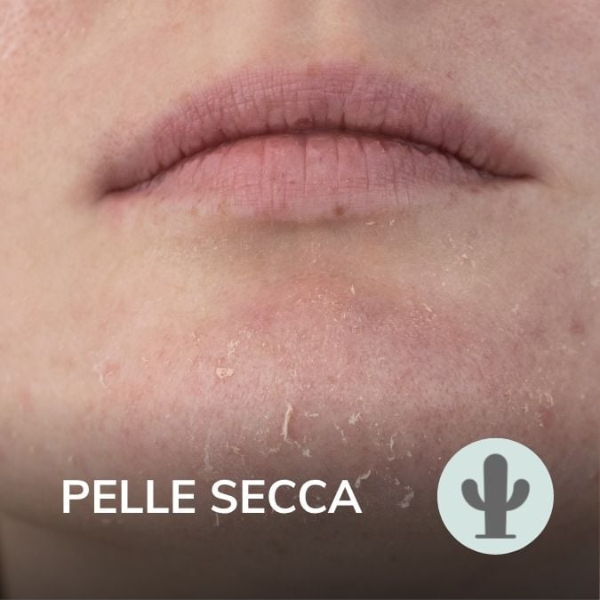 Pelle secca