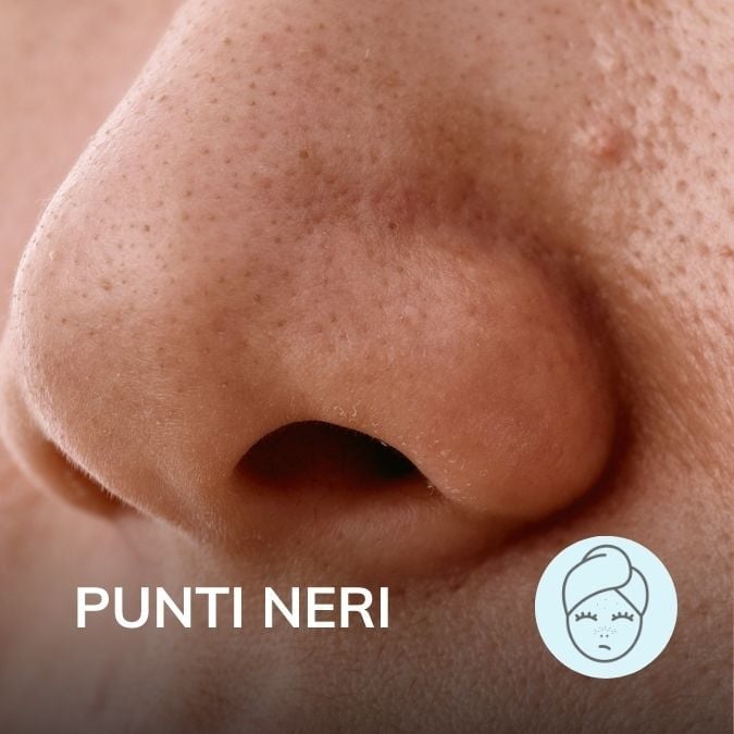 Punti neri