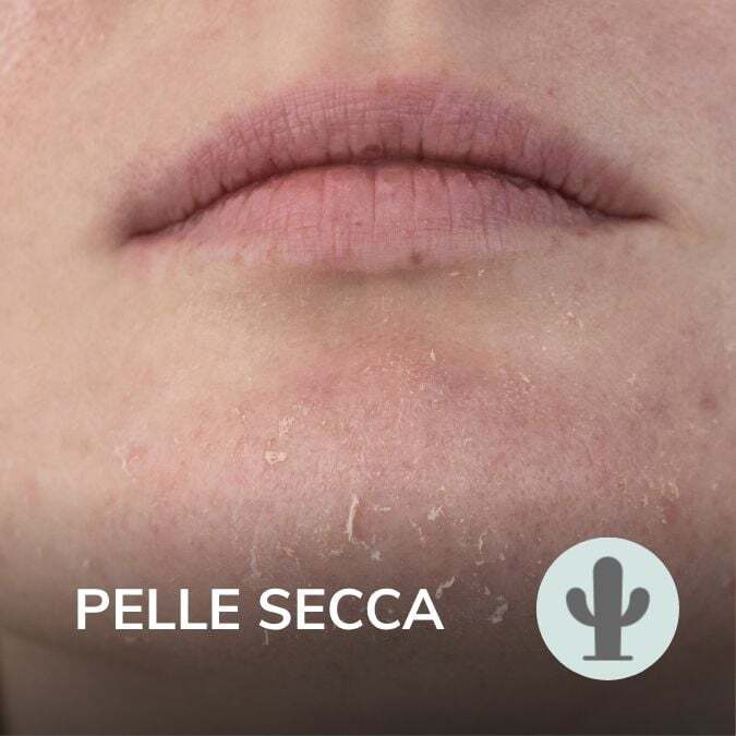 pelle_secca