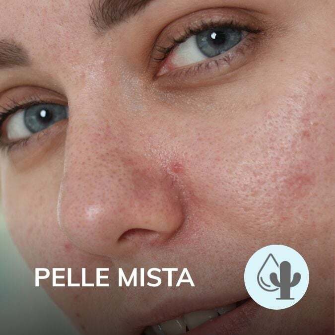 pelle_mista