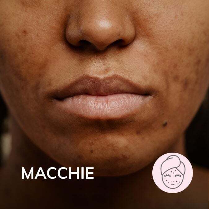 macchie
